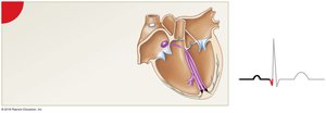 Impulse travels along AV bundle and bundle branches, Q wave