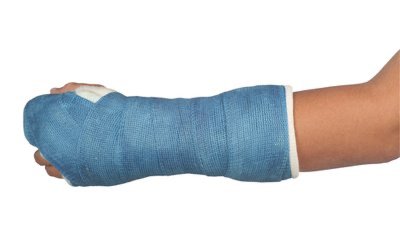 Lamellae structure in bone