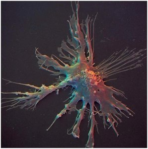 Dendritic cell