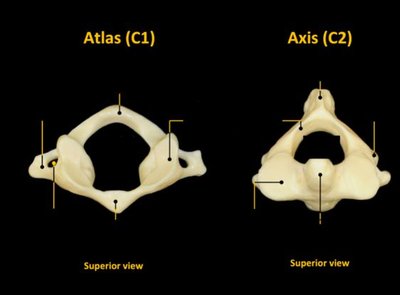 Superior view of Atlas (C1) and Axis (C2)