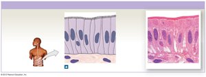 Simple columnar epithelium in intestinal lining