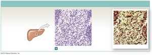 Reticular tissue supporting organs