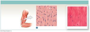 Dense irregular connective tissue in dermis