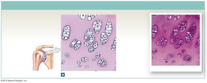 Hyaline cartilage in articulations and respiratory tract