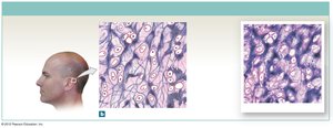 Elastic cartilage in auricle of ear