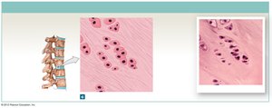 Fibrocartilage in meniscus and intervertebral discs
