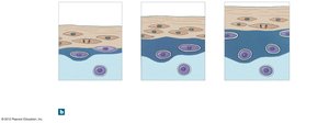 Appositional growth of cartilage