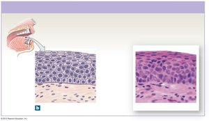 Stratified squamous epithelium in the mouth and skin