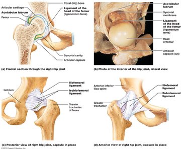 Torn ligaments and meniscus in knee joint