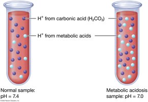 Hydrogen ions in normal and metabolic acidosis samples