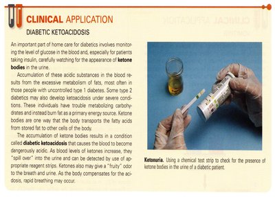 Clinical application: Diabetic ketoacidosis and ketonuria