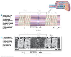 Sarcomere structure with bands and lines