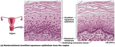 Keratinized stratified squamous epithelium (epidermis)