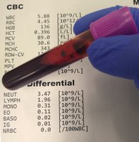CBC test tube and results