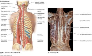 Muscles of the vertebral column