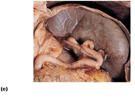 Photograph of the spleen in the abdominal cavity