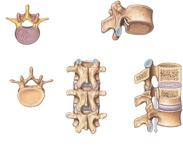 Anatomy of a typical vertebra