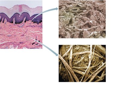 Micrographs of papillary and reticular layers of the dermis