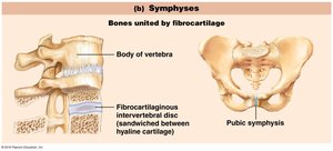 Symphyses: Bones united by fibrocartilage