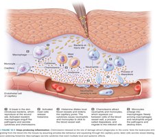 Steps producing inflammation