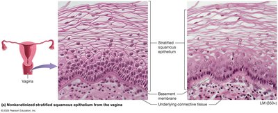Nonkeratinized stratified squamous epithelium