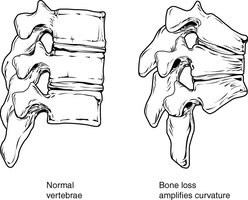 Thoracic cage: sternum and ribs