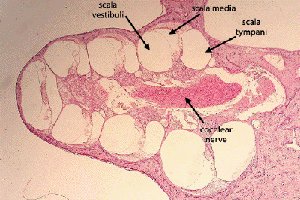Cross-section of the cochlea showing scala vestibuli, scala media, and scala tympani