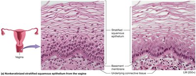 Nonkeratinized stratified squamous epithelium