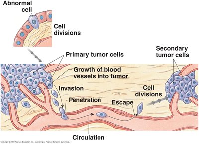 Tumor growth and metastasis