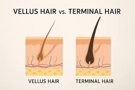 Cross-section of hair follicle and hair structure