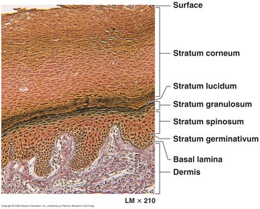 Histological section of epidermis showing its layers
