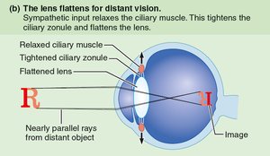 Lens flattens for distant vision