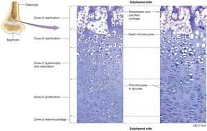 Zones of the epiphyseal plate during longitudinal growth