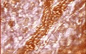 Microscopic view of blood tissue