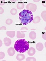 Blood smear showing basophils