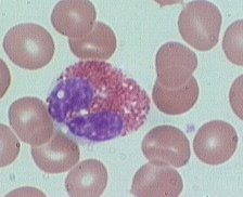 Eosinophil blood smear