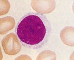 Lymphocyte blood smear
