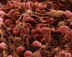 SEM image of blood clot
