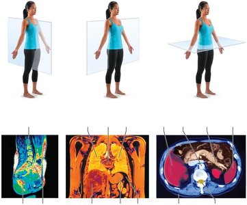 Body planes and MRI scans