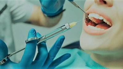 Dental injection of local anesthetic with epinephrine