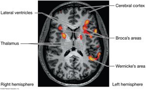 Functional neuroimaging (fMRI) of the brain during speech