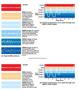 EEG patterns and sleep stages