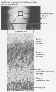 Epiphyseal plate closure