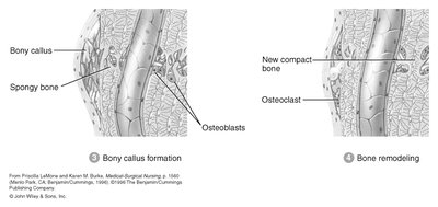 Bony callus formation and bone remodeling