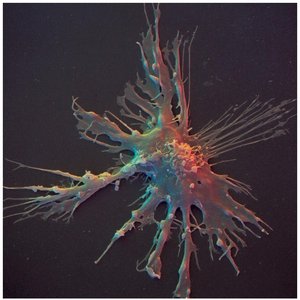 Dendritic cell micrograph
