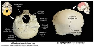 Inferior view of occipital bone and lateral view of parietal bone