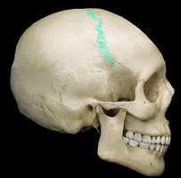 Superior view of the skull showing the coronal suture