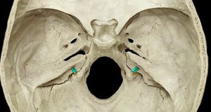 Inferior view of the skull showing the foramen magnum