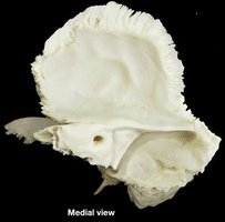 Lateral view of the skull highlighting the temporal bone