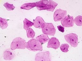 Wet mount of stained cheek cells under the microscope